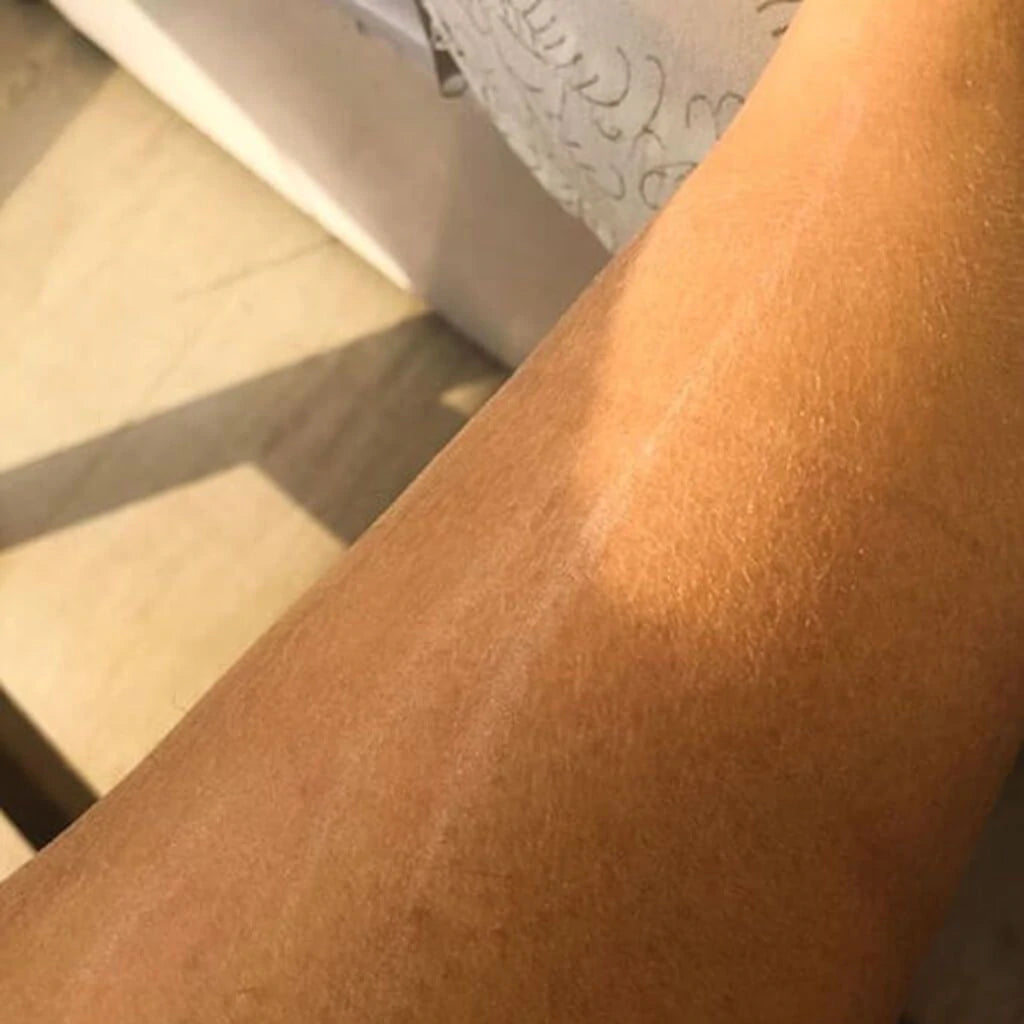 Balaayah Urdbohne Körper-Booster - Packung mit 5